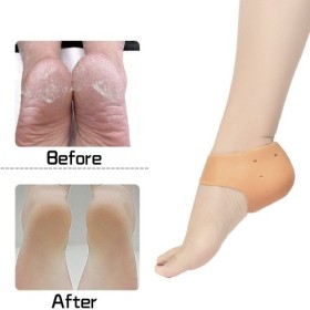 Heel Anti Crack Sets